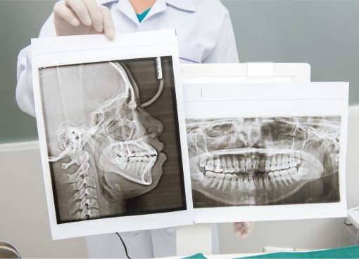 digital x ray in dentistry