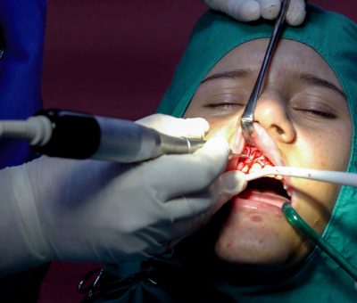 oral surgery procedures