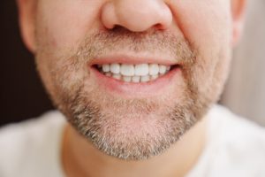 Gum Graft vs Pinhole